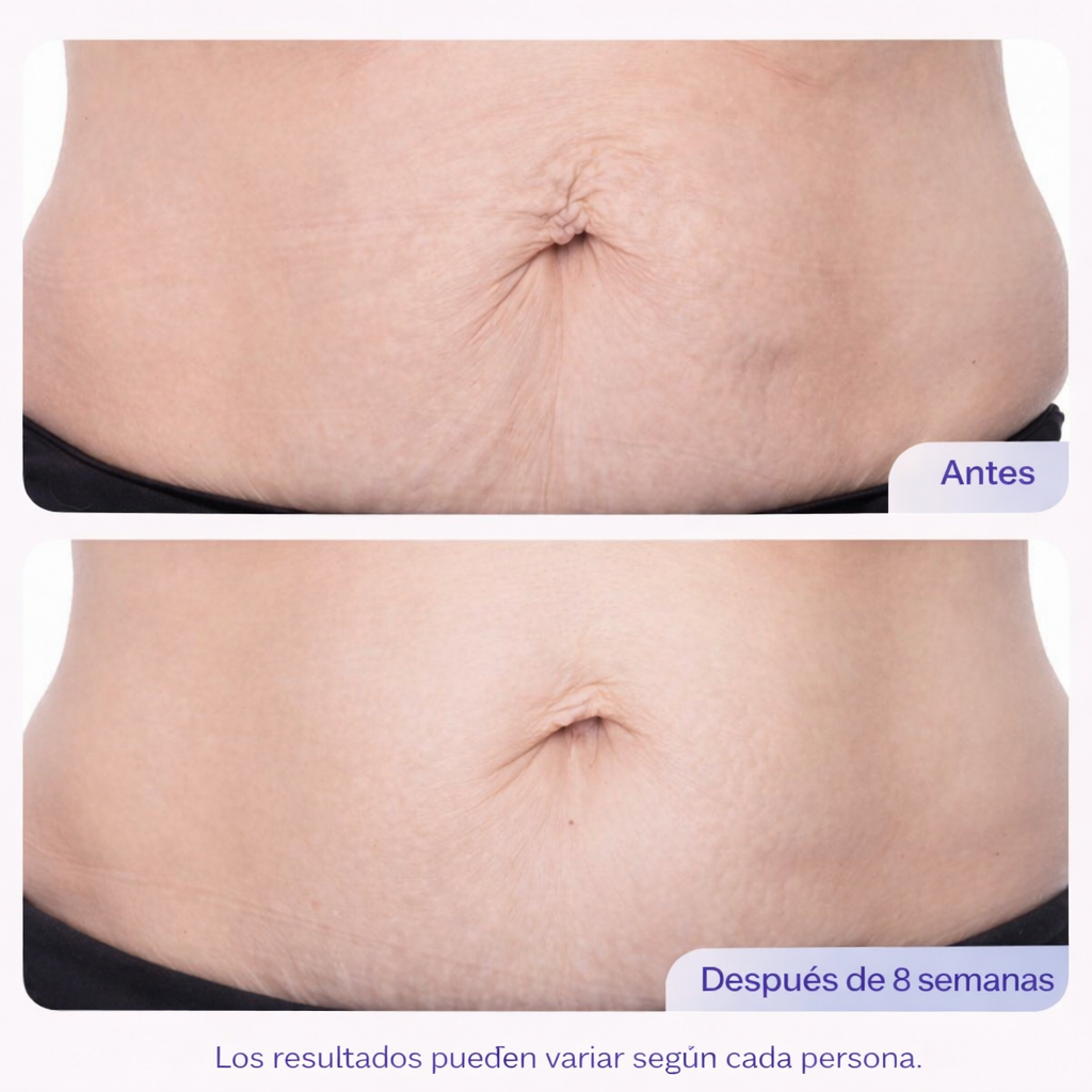 Go Pure - Crema para las estrías