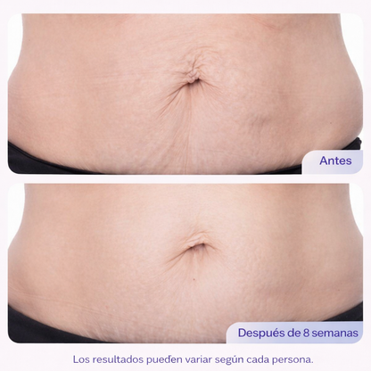 Go Pure - Crema para las estrías